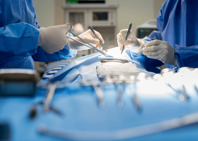 surgical treatment of endometriosis