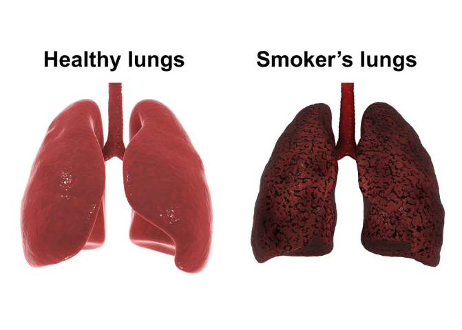 smokers lungs