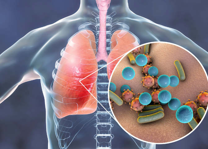 chest infections are caused by viruses and bacteria